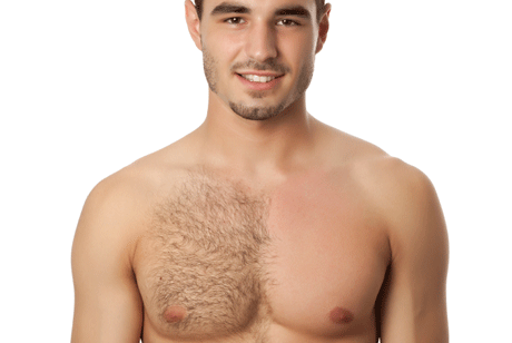 הסרת שיער לגברים